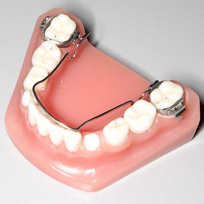 Braces Emergency - What to do if you have a Poking Wire - Tooth Time Family  Dentistry New Braunfels 